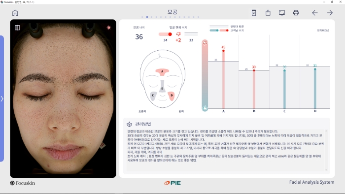 포커스킨 모공 분석 분석화면