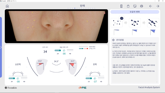 포커스킨 탄력 분석화면