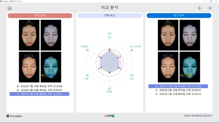 포커스킨 이전 촬영 비교 분석 화면