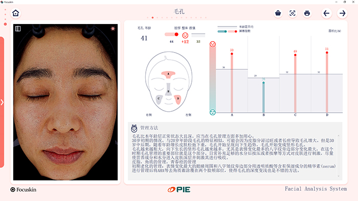 FOCUSKIN 毛孔分析界面