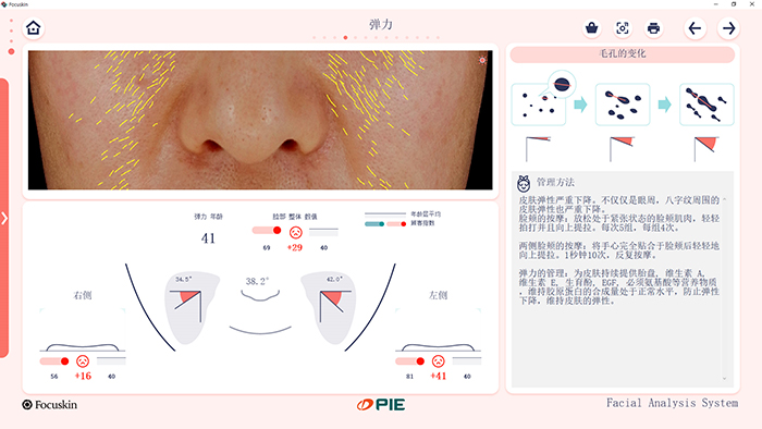 FOCUSKIN 弹性分析界面