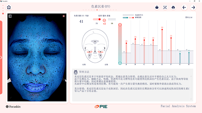 FOCUSKIN UV色素沉着分析界面