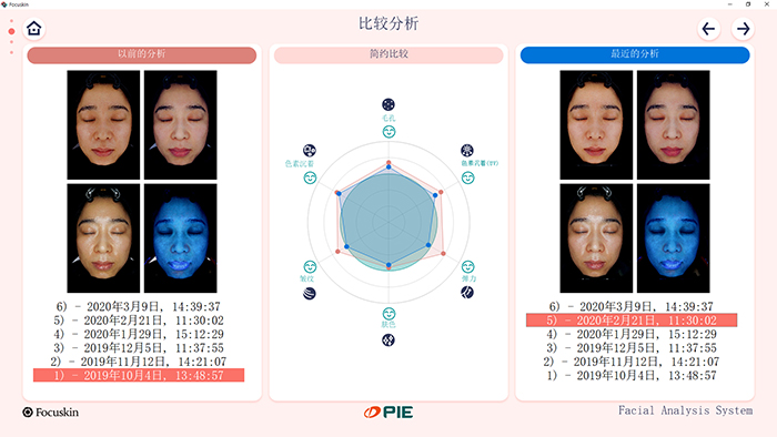 FOCUSKIN 与以往拍摄结果进行对比分析的界面