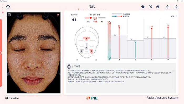 FOCUSKIN 毛穴分析画面