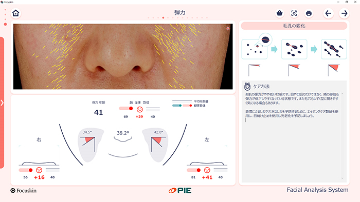 FOCUSKIN 弾力分析画面