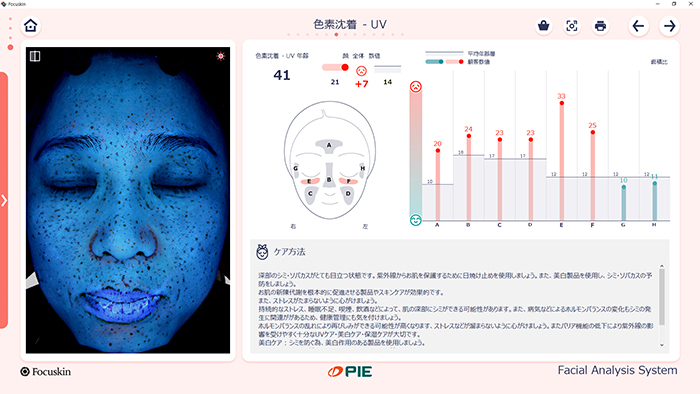 FOCUSKIN UV色素沈着分析画面