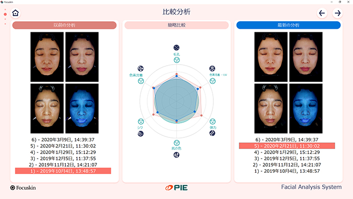 FOCUSKIN 過去撮影との比較分析画面