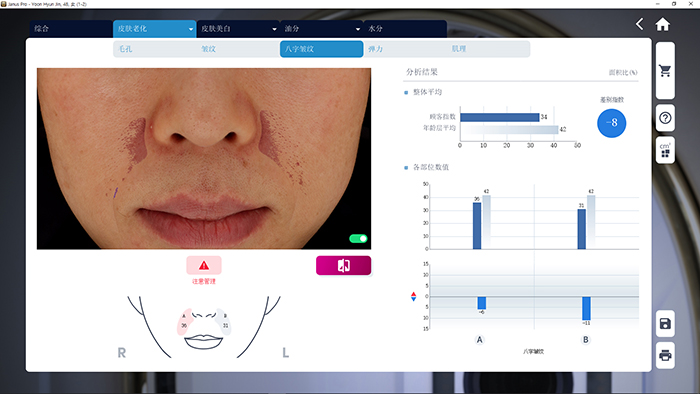 JANUS Pro 法令纹分析界面