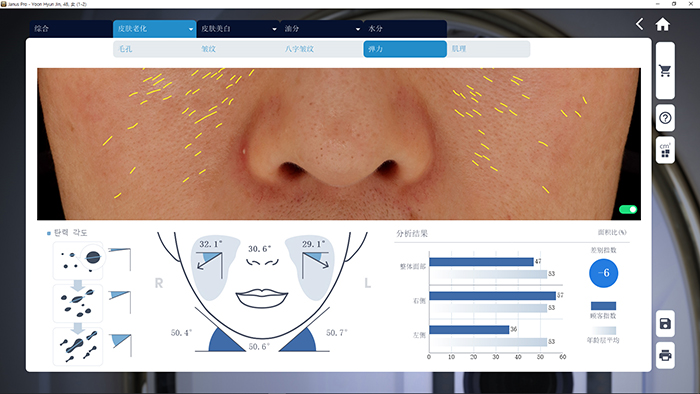JANUS Pro 皮肤弹性分析界面