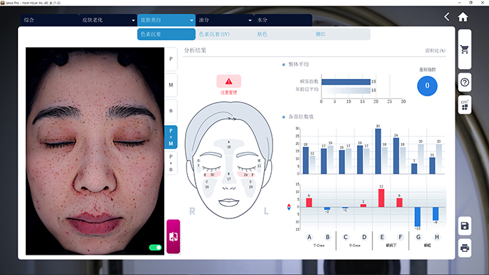 JANUS Pro 色素沉着分析界面