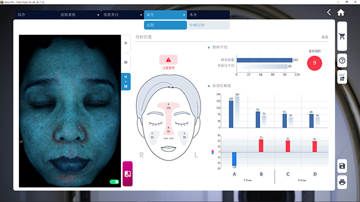 JANUS Pro UV光拍摄的皮脂及卟啉分析界面