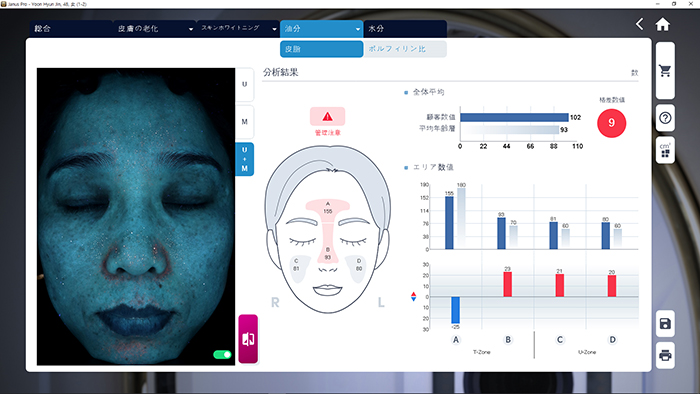 JANUS Pro UV光撮影による皮脂・ポルフィリン分析画面