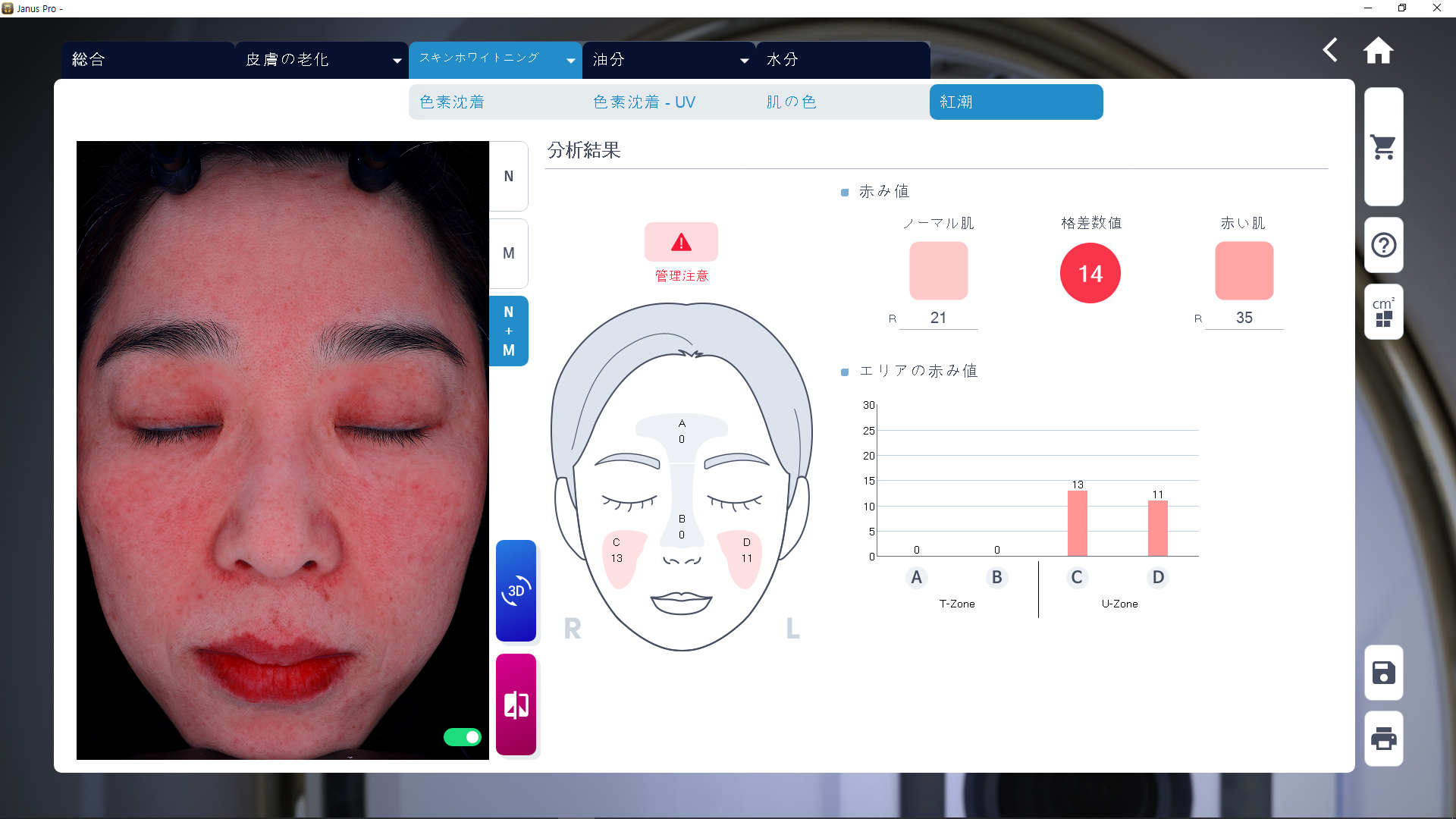 JANUS Pro 赤み分析画面