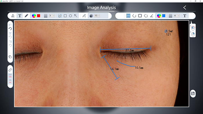 Image Analysis
