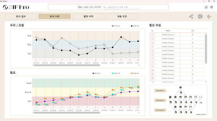 SIF Pro 한 화면에서 분석 가능한 이력 화면