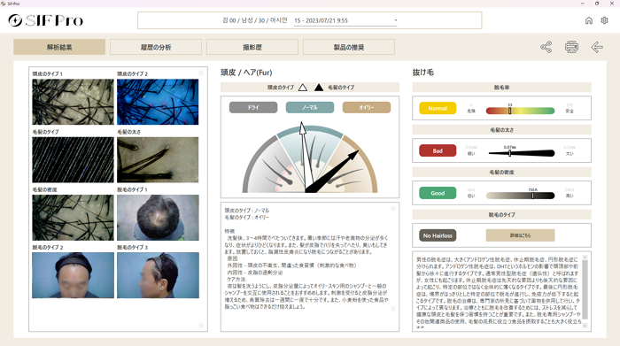 SIF Pro 毛髪分析結果画面