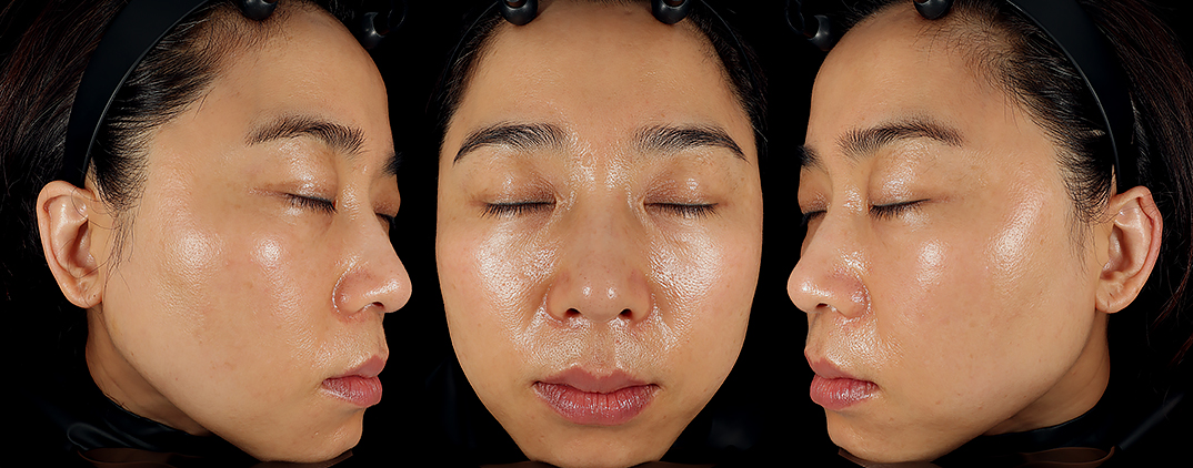 pore skin analysis machine direction