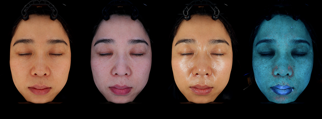 pore skin analysis machine light