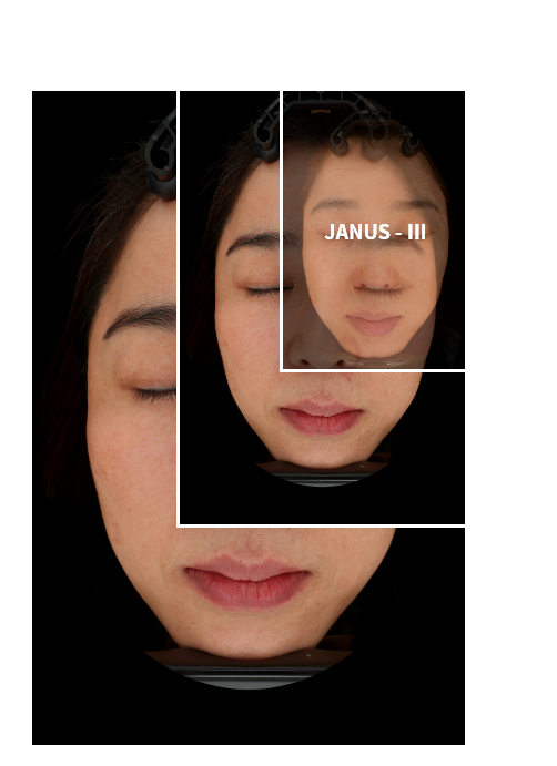 bigdata skin analysis device size