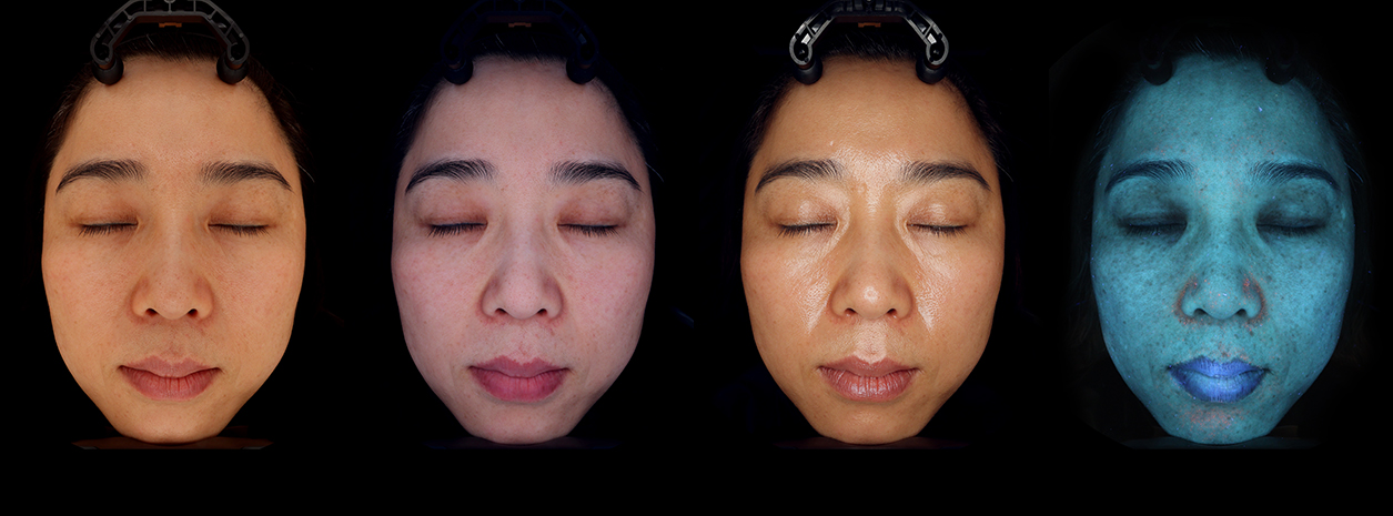 3d facial skin analysis light