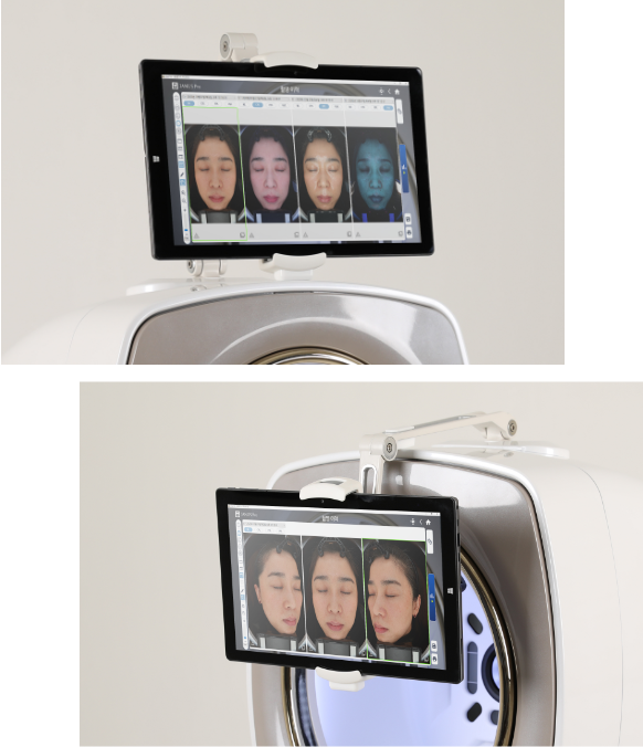 facial skin analysis machine tablet